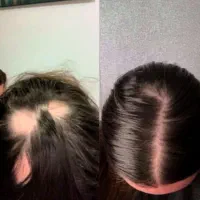 برای همیشه کامل درمیاد