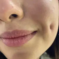 یلدایی چالگونه دائم با بخیه و انواع پیرسینگ|خدمات آرایشگری و زیبایی|گرگان, |دیوار