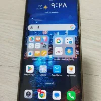 آنر x9|موبایل|تهران, پرستار|دیوار