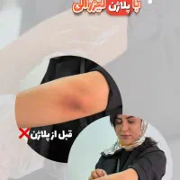 اپراتور لیزر ومنشی مطب|استخدام درمانی، زیبایی، بهداشتی|قم, صدوق|دیوار