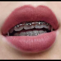 ارتودنسی دندان|خدمات آرایشگری و زیبایی|شیراز, خلدبرین|دیوار