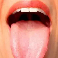 درمان  بیمارهای شما از طریق زبان شما