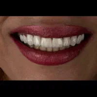 دندانپزشکی کامپوزیت، عصب کشی، ایمپلنت