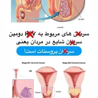 بهبودی کامل و بدون بازگشت زگیل تناسلی HPV