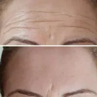 کرم بیوممتیک ۱۲ کاره برای لیفت پوست و جوانسازی