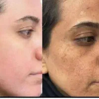 کرم روشن کننده خارجی مکمل چاقی صورت تضمینی|آرایشی، بهداشتی، درمانی|بندر ماهشهر, |دیوار