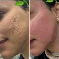 آموزش صفرتاصد پاکسازی/آموزش فیشال|خدمات آموزشی|شیراز, معالیآباد|دیوار