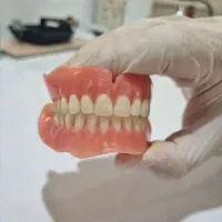 ساخت انواع دندان با بهترین قیمت و کیفیت