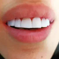 دندانپزشکی در خرم آباد با تخفیف ویژه|خدمات آرایشگری و زیبایی|دورود, |دیوار