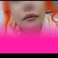 جشنواره فوق العاده ژل و بوتاکس تمامی خدمات زیبایی