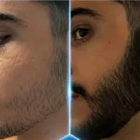 خداحافظی با کوِسه