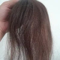 فروش پروتز مو طبیعی