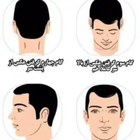 کاشت مو و ابروی طبیعی