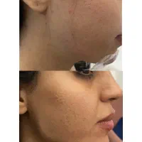 خدمات تزریق ژل و بوتاکس