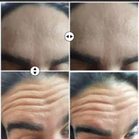 ژل و بوتاکس در منزل شما|خدمات آرایشگری و زیبایی|کرمانشاه, |دیوار