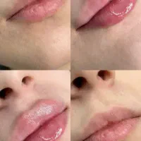 تتو ،میکروبلیدینگ،بوتاکس ،فیلر الی