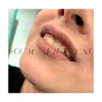 خدمات پیرسینگ. سوراخ کردن گوش وبینی. پرسینگ|بدلیجات|مشهد, طلاب|دیوار