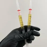 پی ارپی،مزو تراپی مو و صورت|خدمات آرایشگری و زیبایی|خرمآباد, |دیوار