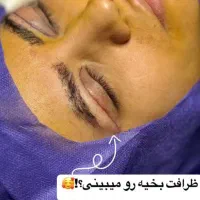 کلینیک زیبایی|خدمات آرایشگری و زیبایی|شیراز, فضل‌آباد|دیوار