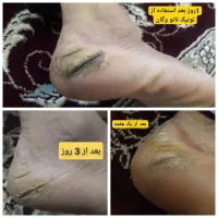 تونیک نانو نقره از محصولات سلامتی و مراقبت  اریا|آرایشی، بهداشتی، درمانی|قرچک, مهدیه|دیوار