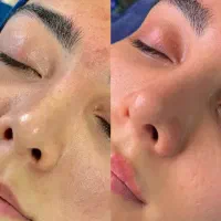 فیشیال تخصصی پوست