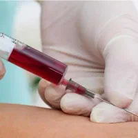 انجام آزمایشات طبی در منزل و محل کار سراسر تهران