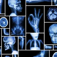 خرید انواع ضایعات با بالاترین قیمت روز|خدمات پیشه و مهارت|تربت‌حیدریه, باغ سلطانی|دیوار