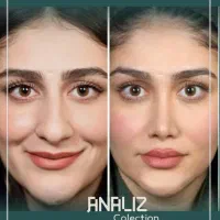 آفر ویژه عمل بینی پلک/کاشت مو/دندان/غبغب/لیپوابدو|خدمات آرایشگری و زیبایی|شیراز, معالی‌آباد|دیوار