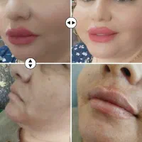 ژل و بوتاکس در منزل شما|خدمات آرایشگری و زیبایی|کرمانشاه, |دیوار