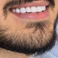 جشنواره اقساطی دندانپزشکی بدون پیش پرداخت|خدمات آرایشگری و زیبایی|شیراز, بعثت|دیوار