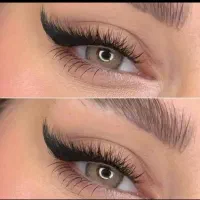 کاشت واکستنشن مژه