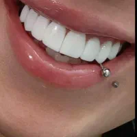 خدمات درمانی و زیبایی دندان|خدمات آرایشگری و زیبایی|کرمانشاه, |دیوار