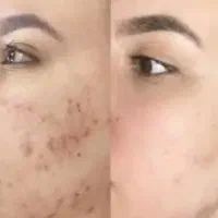 فرمول کرم سفید برفی