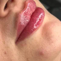 فیلر لب به سبک روسی و کانتور صورت