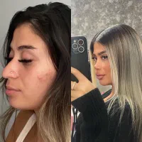 تخفیف ویژه جراحی بینی|خدمات آرایشگری و زیبایی|ورامین, ورامین|دیوار