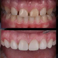 دندانپزشکی گران نیست، غفلت گران است(نقد اقساط)|خدمات آرایشگری و زیبایی|شیراز, گلدشت معالی‌آباد|دیوار
