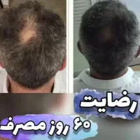 درمان و رویش مجدد مو.تقویت مژه . تقویت ناخن