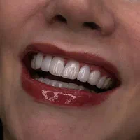 دندانپزشکی، کامپوزیت دندان|خدمات آرایشگری و زیبایی|تهران, تهرانپارس غربی|دیوار
