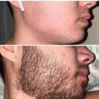 لحظات هیجانی بعد نتیجه گرفتن خفنه