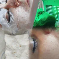 خدمات فشیال با کمترین قیمت