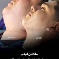 همه جراحی های زیبایی باشرایط اقساط و وام بدون ضامن|خدمات آرایشگری و زیبایی|تهران, فلسطین (میدان انقلاب)|دیوار