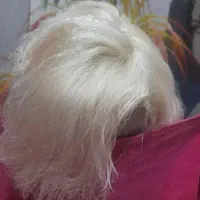 آرایشگروتزریقات سیارباتخفیف ویژه