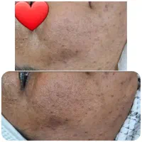 اموزشگاه ومرکز تخصصی پوست|خدمات آموزشی|زرند, |دیوار