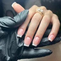 ترمیم و کاشت با فرنچ رایگان