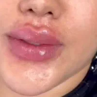 مطب VIP زیبایی دکتر دهقانی(بوتاکس،فیلر،جوانساز)|خدمات زیبایی و سلامت|اهواز, کیانپارس |دیوار