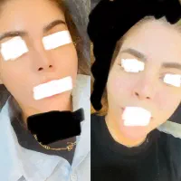 خدمات فیشیال