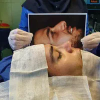عمل بینی با تخفیف جشنواره تابستانه ویژه فقط ۲۵تومن|خدمات آرایشگری و زیبایی|تهران, عباس‌آباد|دیوار