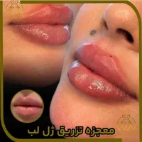 جشنواره کلینیک تزریق ژل لب متدM لیزر390بوتاکس|خدمات آرایشگری و زیبایی|تهران, سعادت‌آباد|دیوار