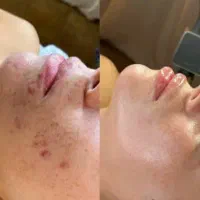 مدل فیشال و پدیکور برای امروز و فردا