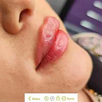 ۴۵۰،۰۰۰ ت هدیه باشگاه مشتریان یاناومایا (فیلر لب)